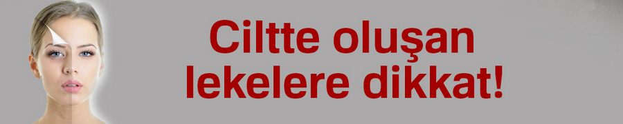 Ciltte oluşan lekelere dikkat