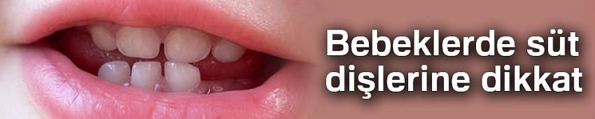 Bebeklerde süt dişlerine dikkat