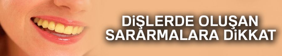 Dişlerde oluşan sararmalara dikkat