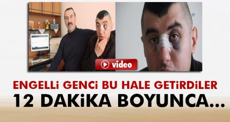 Erzurum