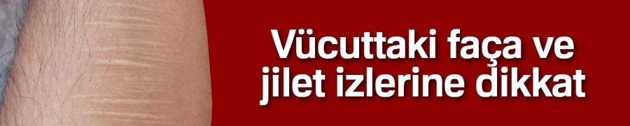 Vücuttaki faça ve jilet izlerine dikkat